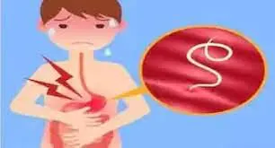 बच्चों-किशोरों को 10 फरवरी को खिलाई जाएगी पेट के कीड़े निकालने की दवा