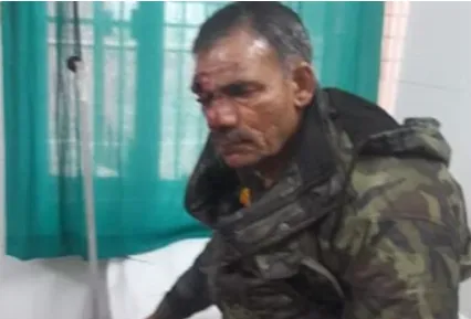 बागपत में मोटरसाइकिल फिसलने से पुलिस उपनिरीक्षक घायल