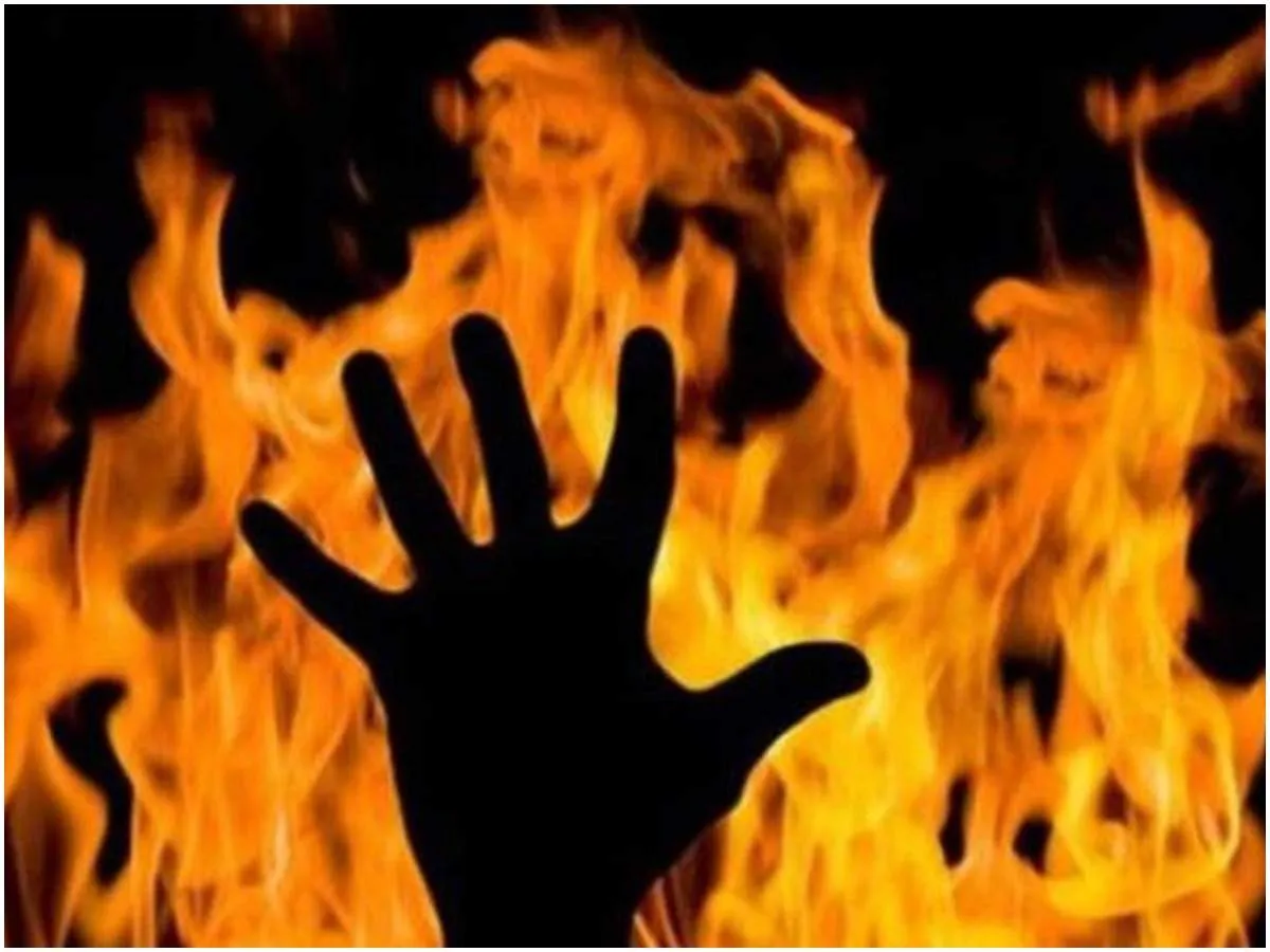 आपसी विवाद के चलते पति-पत्नी ने एक-दूसरे पर पैट्रोल डालकर लगाई आग