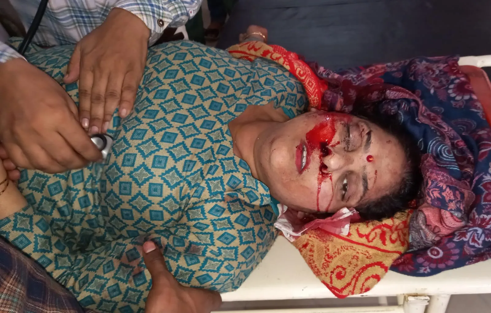 कैराना में अनियंत्रित कार डिवाइडर से टकराकर पलटी, महिला की मौत