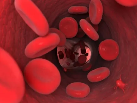 आयुर्वेद के 3 उपाय दूर करेंगे एनीमिया की परेशानी, रखना होगा कुछ विशेष बातों का ध्यान 