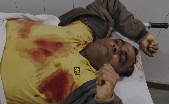 मुजफ्फरनगर में बड़ा एनकाउंटर: 50 हजार का इनामी बदमाश अमजद ढेर, पुलिस टीम पर कार्बाइन से बरसाईं गोलियां