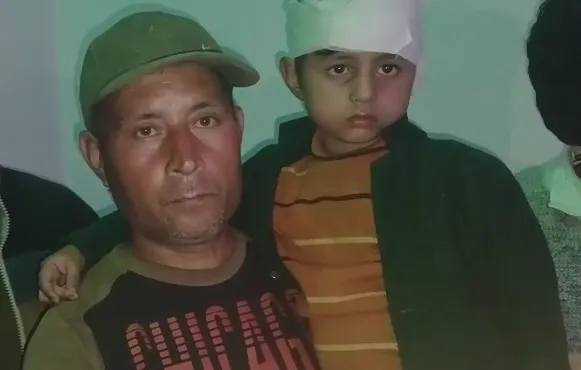 देवबंद में आवारा कुत्तों का जबरदस्त आतंक: स्कूल जा रहे दो मासूम भाइयों पर हमला, सीसीटीवी में कैद हुई घटना