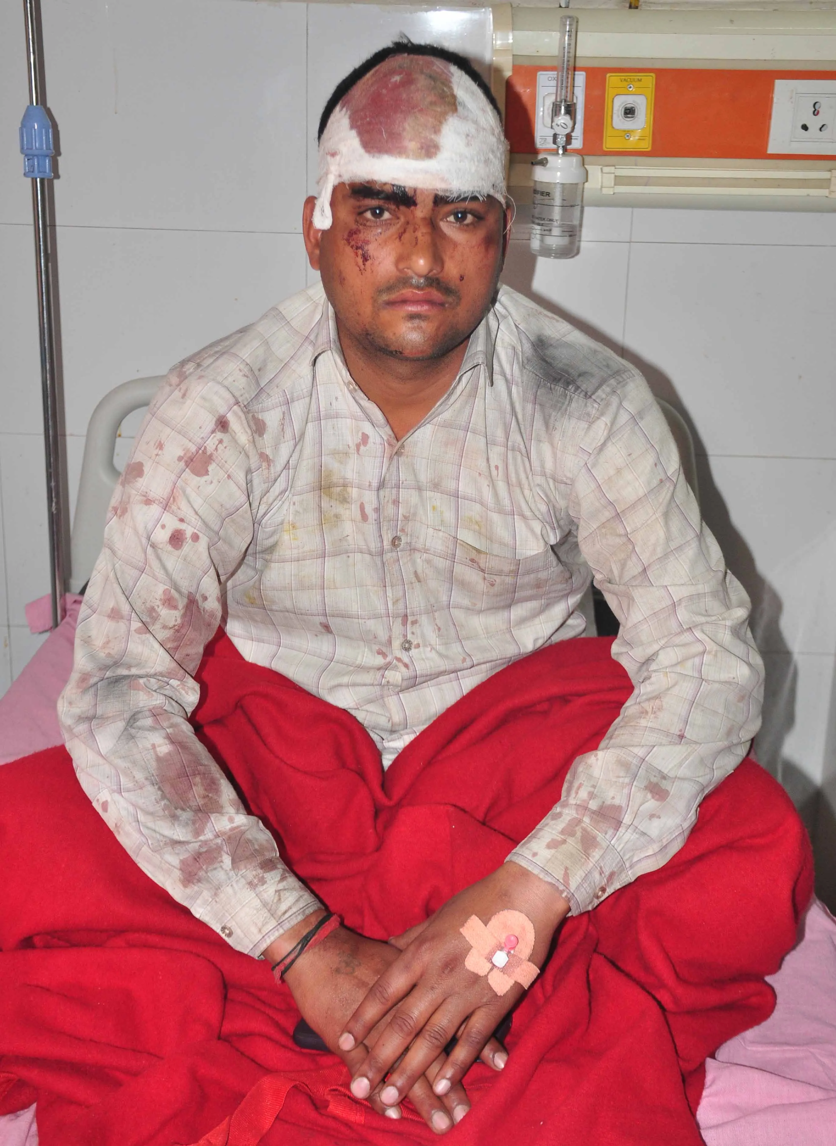 शामली: ढाबे पर विवाद में सिपाही पर लोहे की रॉड से हमला, गंभीर घायल