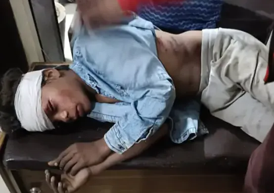 लखनऊ के बंथरा में छात्र ने कार से छह लोगों को रौंदा, मासूम की मौत और पांच गंभीर