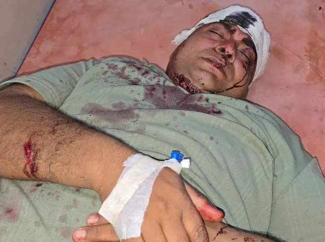 सहारनपुर के गंगोह क्षेत्र में झगड़ा: हिन्दू समाज के दो गुटों की मारपीट में 20 घायल, 6 को अस्पताल रेफर