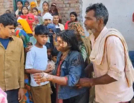 अलीगढ़: चचेरी बहन पर पेट्रोल छिड़ककर लगाई आग; 4 घंटे तक छत पर हाईवोल्टेज ड्रामा करने वाला आरोपी भाई गिरफ्तार