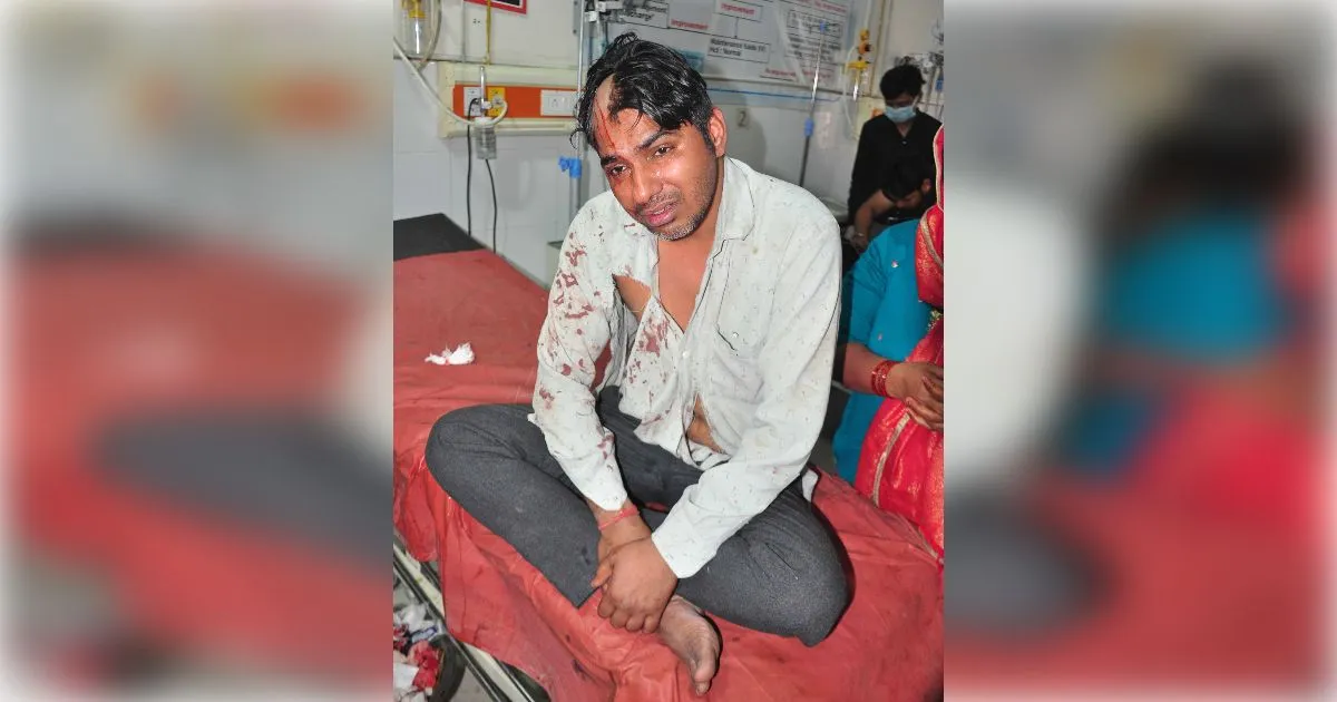 शामली में ब्याज के चंगुल में फंसा युवक, पैसे चुकाने के बाद भी दबंगों ने लोहे की रॉड से सिर फोड़ा