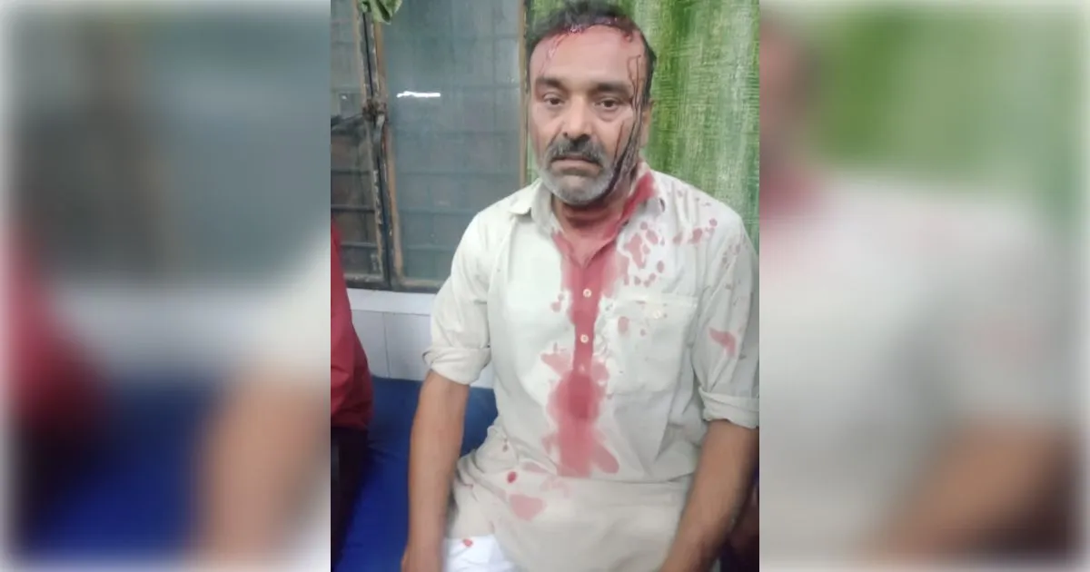 मुजफ्फरनगर में बदमाशों का कार सवार पिता-पुत्र पर जानलेवा हमला, दोनों घायल अस्पताल में भर्ती