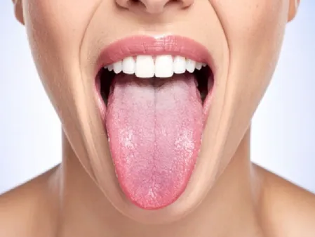 त्रिदोष के असंतुलन का संकेत देती है जीभ, रंग से पहचाने शरीर के विकार 