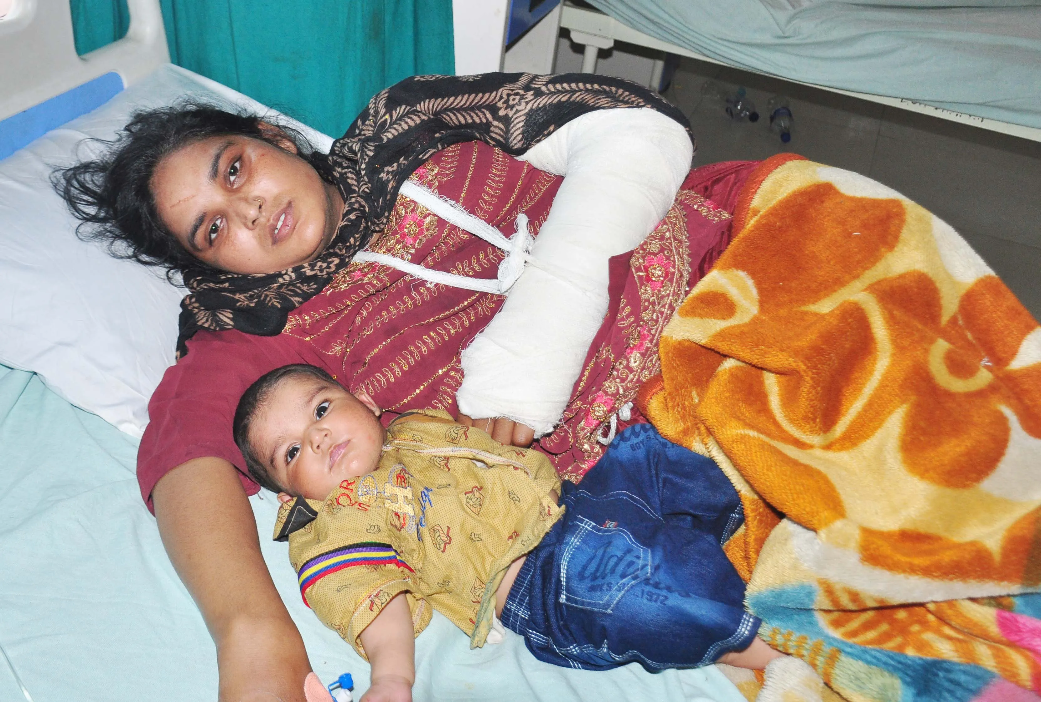 शामली: ससुराल पक्ष ने विवाहिता को कमरे में बंद कर पीटा, एक हाथ की हड्डी टूटी