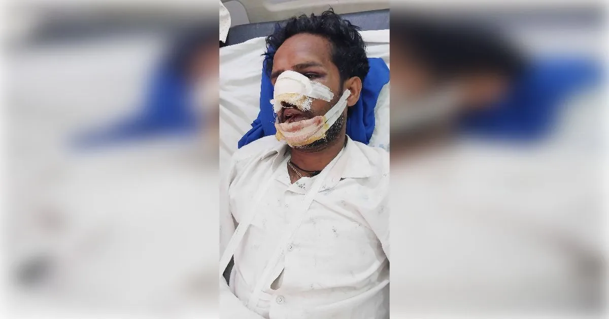 शामली में ट्रक के अचानक ब्रेक मारने से बाइक सवार की टक्कर, युवक की अस्पताल में हालत नाजुक