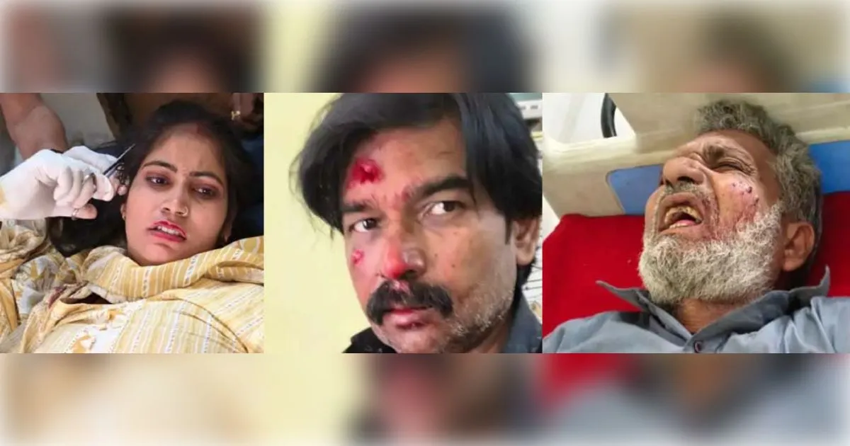 मुजफ्फरनगर के खतौली में कार ने मारी बाइक और स्कूटी को टक्कर, तीन घायल