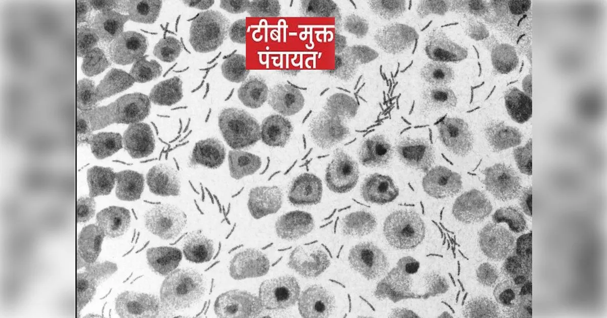 सहारनपुर में टीबी मुक्त अभियान: 90 ग्राम पंचायतें टीबी मुक्त घोषित