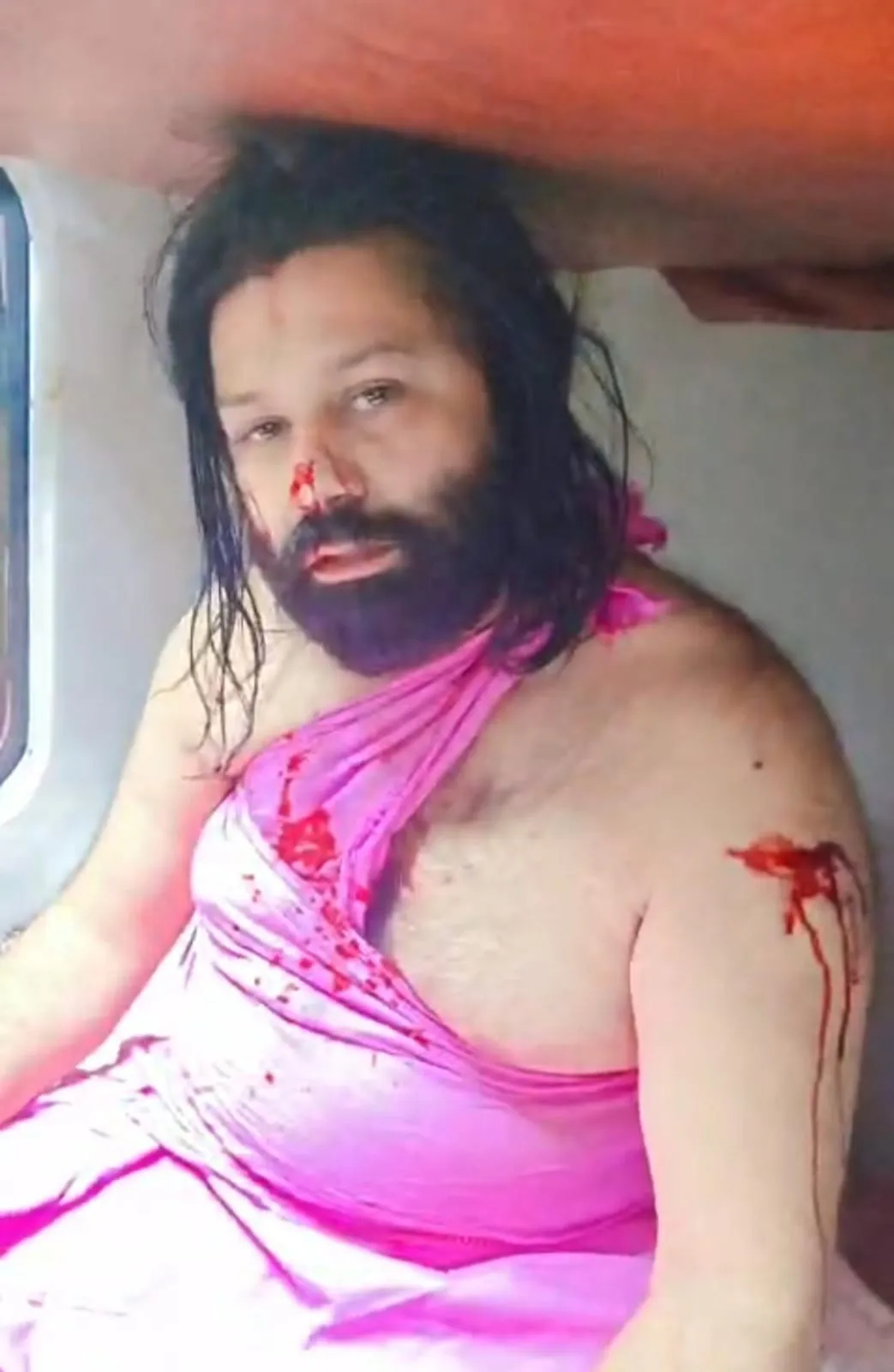 स्वामी अविमुक्तेश्वरानंद के खिलाफ केस करने वाले आशुतोष ब्रह्मचारी पर हमला, धारदार हथियार से नाक काटने की कोशिश; ट्रेन के टॉयलेट में छिपकर बचाई जान