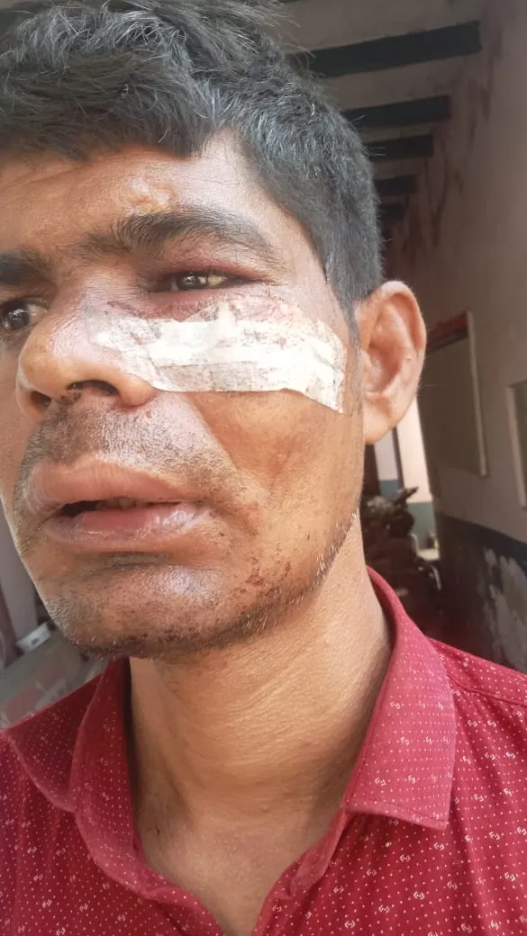 गाजियाबाद: मोदीनगर में दो युवकों के बीच खूनी संघर्ष, सीसीटीवी में कैद हुई मारपीट की लाइव वारदात