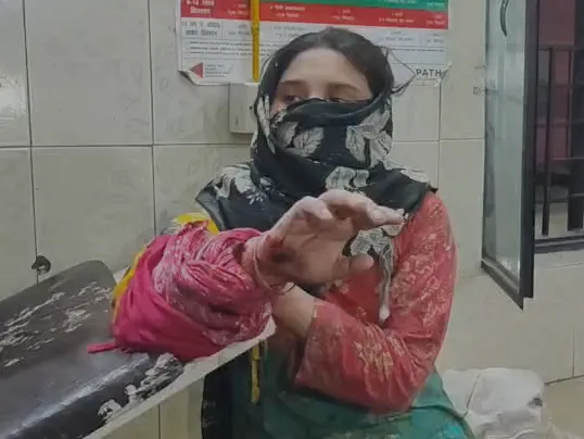 मेरठ में पारिवारिक विवाद में ताबड़तोड़ फायरिंग, साले को गोली मारी; बचाने आई पत्नी पर भी हमला