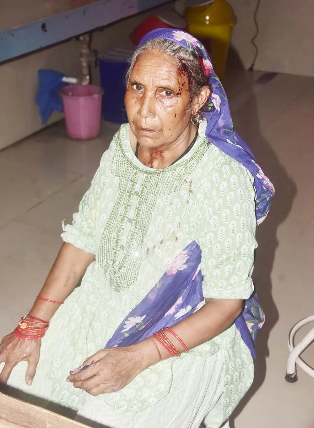शामली में कलयुगी बहू ने सास के सिर में डंडा मारकर किया घायल, पीड़िता ने पुलिस से लगाई न्याय की गुहार