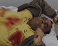 मुजफ्फरनगर में बड़ा एनकाउंटर: 50 हजार का इनामी बदमाश अमजद ढेर, पुलिस टीम पर कार्बाइन से बरसाईं गोलियां