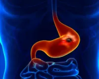 पेट-दर्द सिर्फ पाचन समस्या नहीं, पेट की आंतरिक बीमारियों का भी इशारा है, आयुर्वेद से जानें उपाय