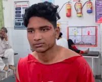 'पहले ठाकुर सामान लेंगे, दलित बाद में'—दुकान पर हुए विवाद में दलित परिवार पर हमला, महिलाओं समेत 5 घायल, CCTV में कैद हुई वारदात