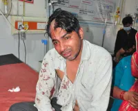 शामली: ब्याज विवाद में युवक पर हमला, सिर में लोहे की रॉड से घायल