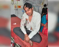 शामली में ब्याज के चंगुल में फंसा युवक, पैसे चुकाने के बाद भी दबंगों ने लोहे की रॉड से सिर फोड़ा