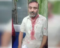 मुजफ्फरनगर में काली नदी के पास बदमाशों का तांडव, कार सवार पिता-पुत्र पर लाठी-डंडों से जानलेवा हमला