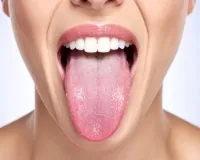 त्रिदोष के असंतुलन का संकेत देती है जीभ, रंग से पहचाने शरीर के विकार 