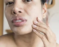 समय से पहले मुरझा रही है त्वचा, अधूरी नींद है झुर्रियों का असली कारण