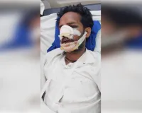 शामली में ट्रक के अचानक ब्रेक मारने से बाइक सवार की टक्कर, युवक की अस्पताल में हालत नाजुक