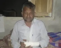  MDA जेई की गुंडागर्दी: बिल्डिंग निर्माण कर रहे मजदूरों को डंडों से पीटा, जान बचाने को छत से कूदे दो मिस्त्री, हाथ-पैर टूटे