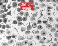 सहारनपुर में टीबी मुक्त अभियान: 90 ग्राम पंचायतें टीबी मुक्त घोषित