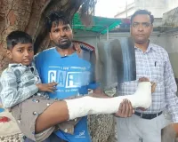 खतौली में स्कूल जा रहे बच्चे को बाइक ने मारी टक्कर, पैर की हड्डी टूटी; गरीब पिता ने मांगी आर्थिक मदद