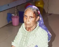 शामली में कलयुगी बहू ने सास के सिर में डंडा मारकर किया घायल, पीड़िता ने पुलिस से लगाई न्याय की गुहार