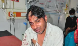 शामली: ब्याज विवाद में युवक पर हमला, सिर में लोहे की रॉड से घायल