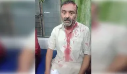 मुजफ्फरनगर में बदमाशों का कार सवार पिता-पुत्र पर जानलेवा हमला, दोनों घायल अस्पताल में भर्ती