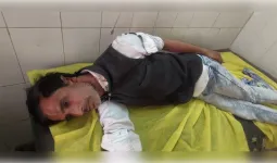 मुजफ्फरनगर के रुड़कली गांव में गंदगी को लेकर संघर्ष, किसान का कान काटा