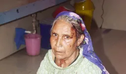 शामली में कलयुगी बहू ने सास के सिर में डंडा मारकर किया घायल, पीड़िता ने पुलिस से लगाई न्याय की गुहार