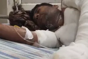 आगरा: शादी से इनकार करने पर प्रेमिका ने प्रेमी को पेट्रोल डालकर जिंदा जलाया, हालत नाजुक