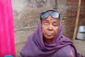 गोरखपुर मेडिकल त्रासदी: मोतियाबिंद ऑपरेशन बना अभिशाप..18 मरीजों का जीवन बर्बाद, 9 की आंखें निकालनी पड़ीं