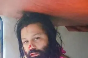 स्वामी अविमुक्तेश्वरानंद के खिलाफ केस करने वाले आशुतोष ब्रह्मचारी पर हमला, धारदार हथियार से नाक काटने की कोशिश; ट्रेन के टॉयलेट में छिपकर बचाई जान