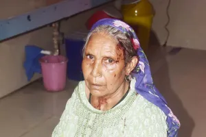 शामली में कलयुगी बहू ने सास के सिर में डंडा मारकर किया घायल, पीड़िता ने पुलिस से लगाई न्याय की गुहार