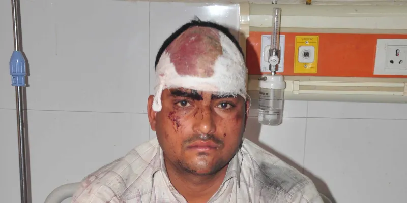 शामली: ढाबे पर विवाद में सिपाही पर लोहे की रॉड से हमला, गंभीर घायल