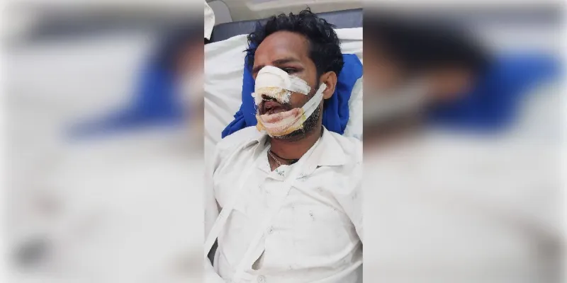 शामली में ट्रक के अचानक ब्रेक मारने से बाइक सवार की टक्कर, युवक की अस्पताल में हालत नाजुक