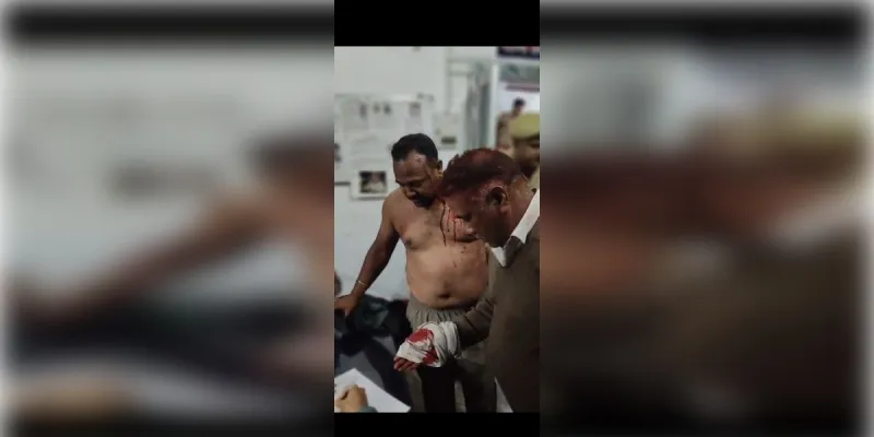 मुजफ्फरनगर: भोपा के ग्राम कासमपुरा में खूनी संघर्ष, युवक पर तलवार से हमला