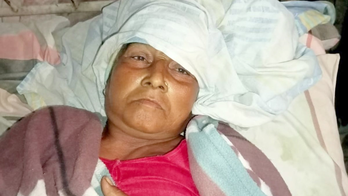 अमरोहा में दर्दनाक हादसा, आवारा सांड ने बुजुर्ग महिला पर किया जानलेवा हमला, पेट फाड़कर बाहर निकलीं आंतें