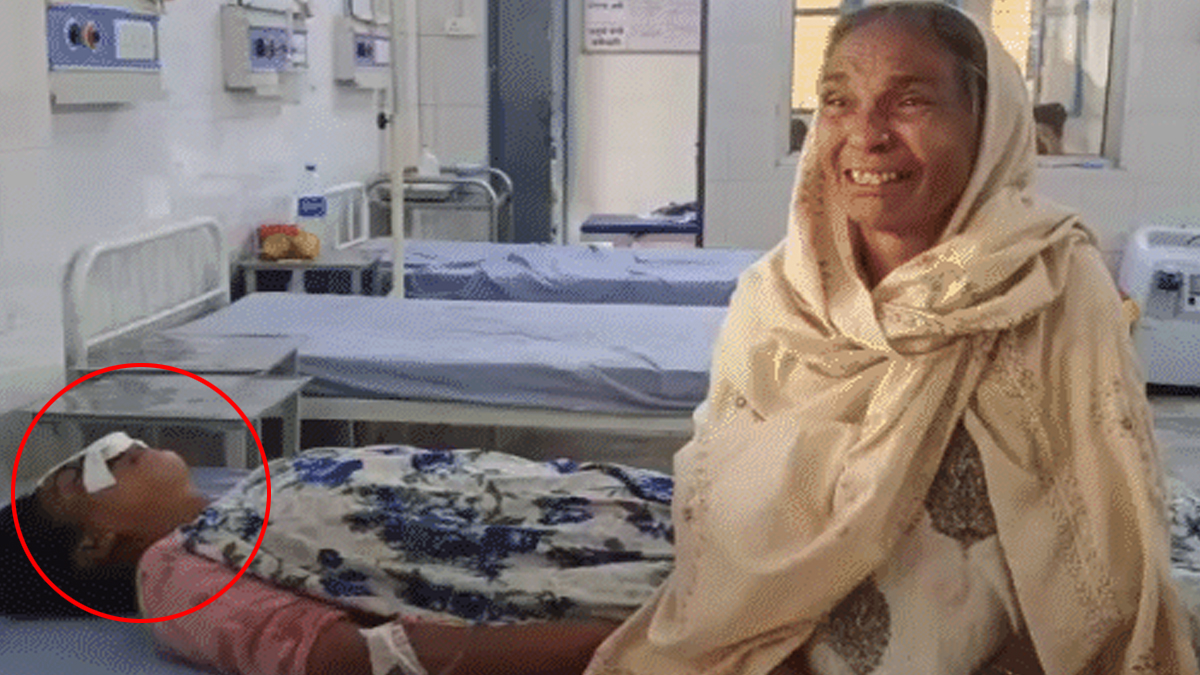 मुरादाबाद में सनसनी! मायके से बात करने पर पति ने पत्नी की नाक काटी, जिंदगी और मौत से जूझ रही पत्नी