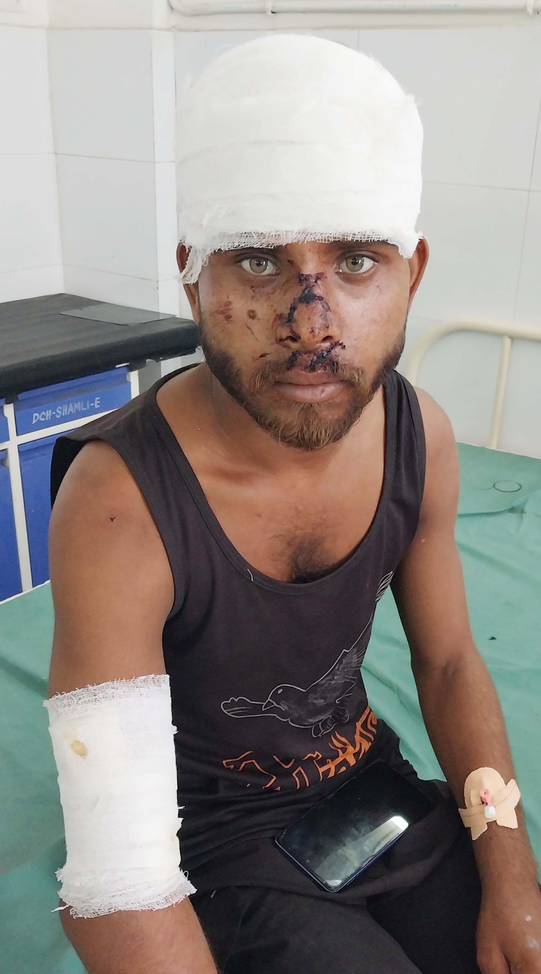 शामली के बुढाना रोड पर बस ने ई-रिक्शा चालक को मारी टक्कर, घायल हुआ चालक