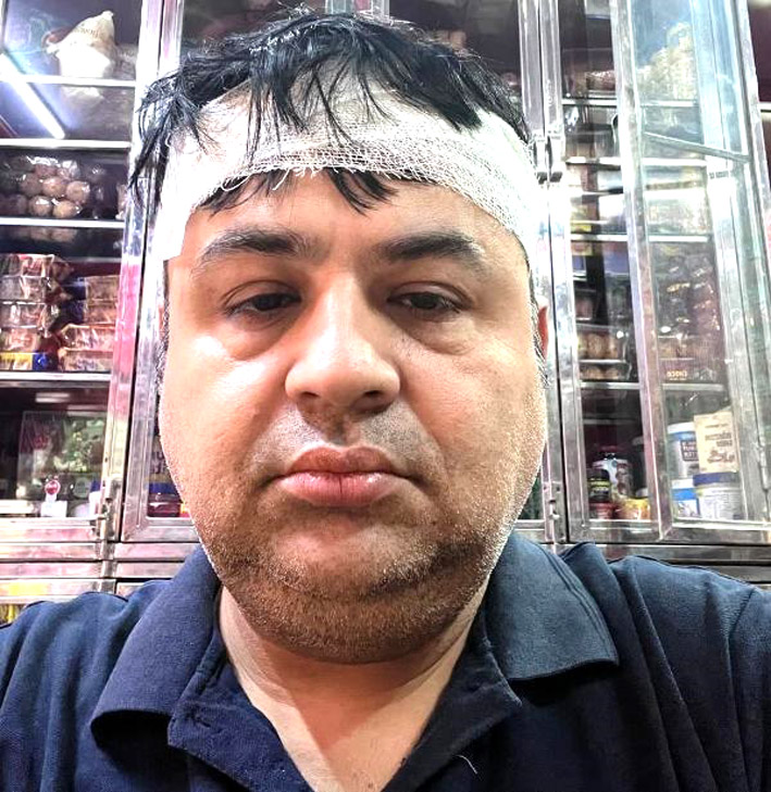सहारनपुर में रामलीला मंचन में असामाजिक तत्वों की पत्थरबाजी, कलाकार घायल
